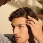 Looking at Thinning Hair: The Therapeutic Triumph of Topical Finasteride